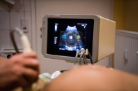 Mobile app development company - inovosystems